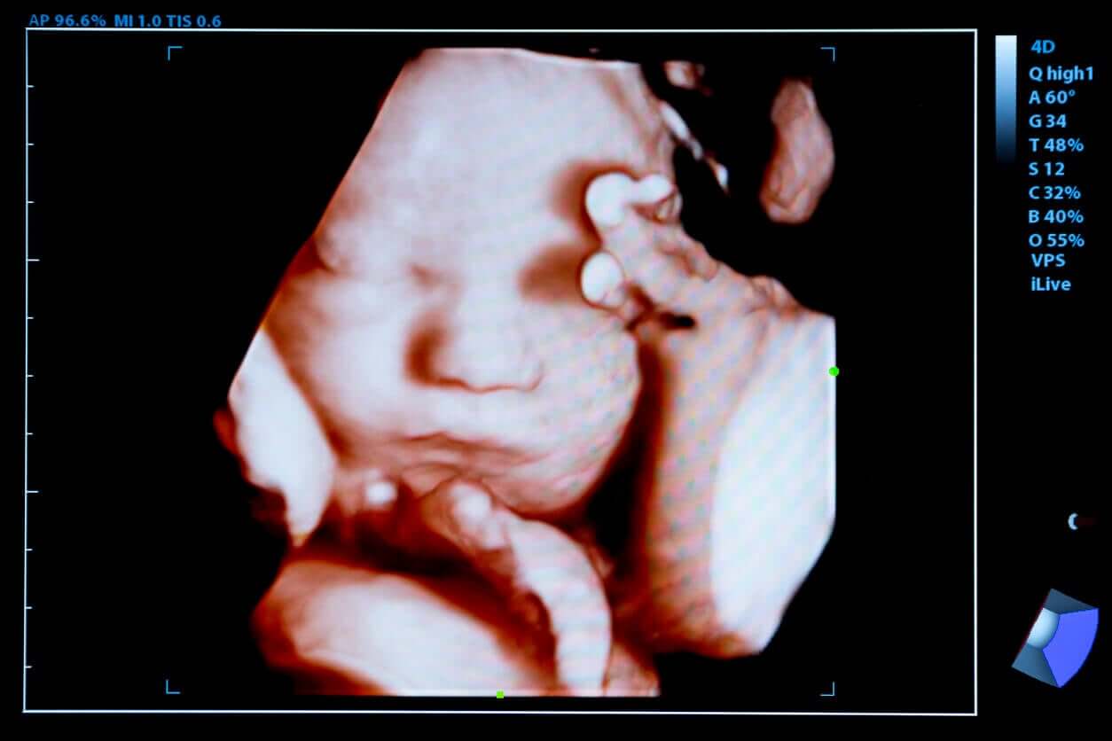 Baby Connections ultrasound studio